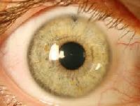 Intraocular Lenses