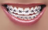 dental bracket