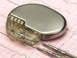 Heart Pacemaker