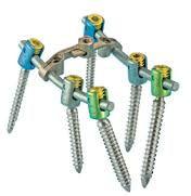 Pedicle Screw