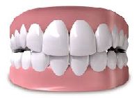 Acrylic Teeth Set