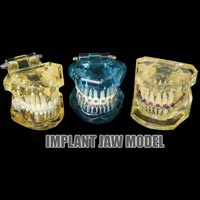 Implant Jaw Model