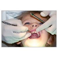dental disease treatment services