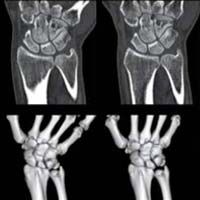 Multi-slice Ct Scanners