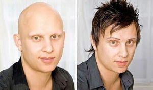cancer patients wig