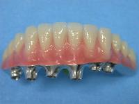 acrylic teeths