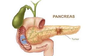 Pancreas Profile