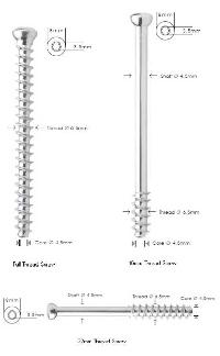 6.5mm Cancellous Cannulated Screws