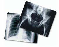 medical xray films