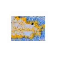 Alcian Yellow