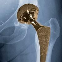 medical implants