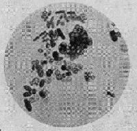 Azotobacter