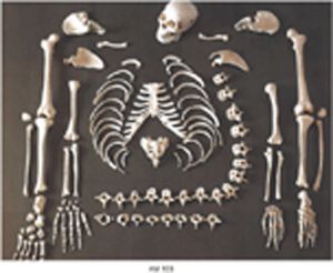 Disarticulated Human Skeleton