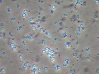Bacillus Thuringiensis