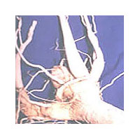 Moringa Tree Roots