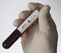 Hiv Test Kit