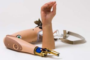 Below Elbow Myo Hand Prosthesis