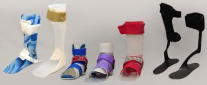 Paediatric Splints