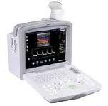 doppler ultrasound scanner