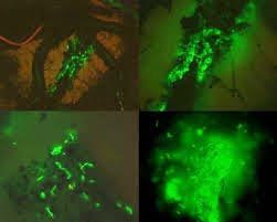 Pseudomonas Fluorescens