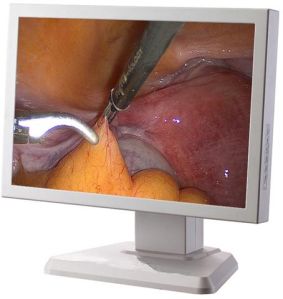 Surgical Grade LCD Display