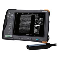 Palm Ultrasound Scanner