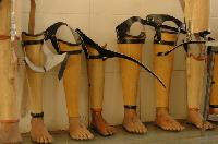 Artificial Limbs