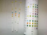 urine analysis strips