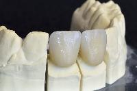 Dental Cements