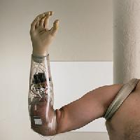 Artificial Limbs