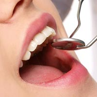 In Home Dentist Visit Services